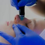 What You Never Knew About HydraFacial